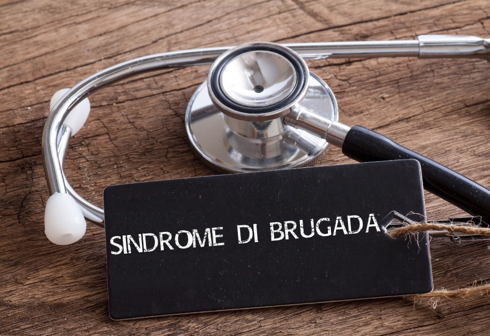 Sindrome di Brugada